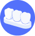 Dental Bridges