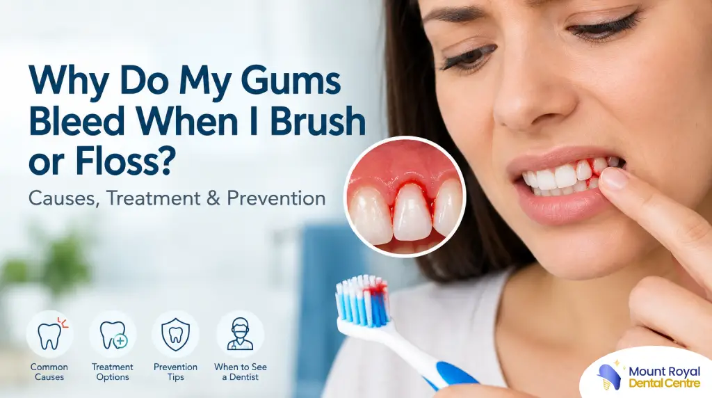 Why Do My Gums Bleed When I Brush or Floss_ Causes, Treatment & Prevention